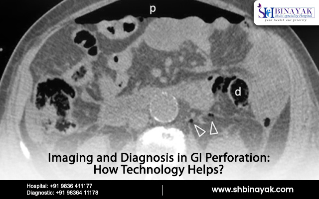 Imaging and Diagnosis in GI Perforation: How Technology Helps?
