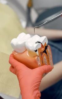 dental-innerbanner-one