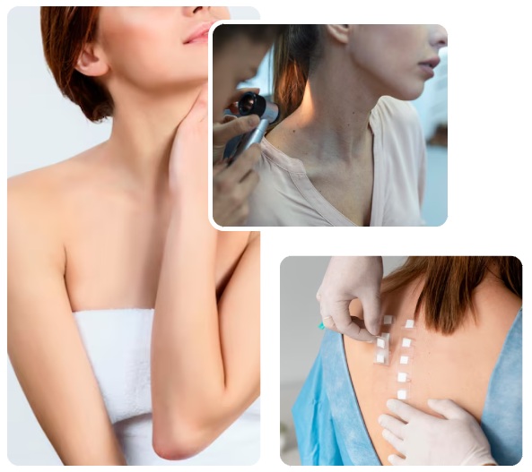 Our Dermatology Treatments Our Dermatology Treatments