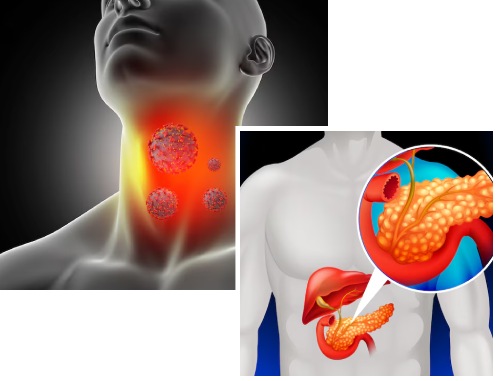 Diagnosis of Endocrine Disorders Diagnosis of Endocrine Disorders