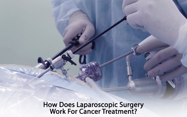 How Does Laparoscopic Surgery Work For Cancer Treatment?
